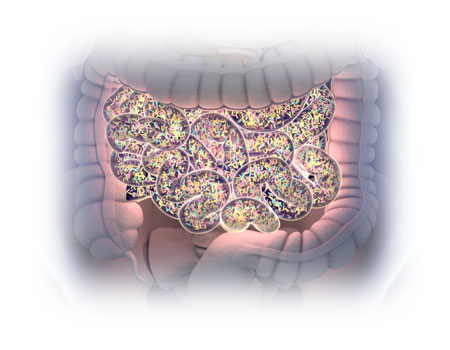 Small intestinal bacterial overgrowth